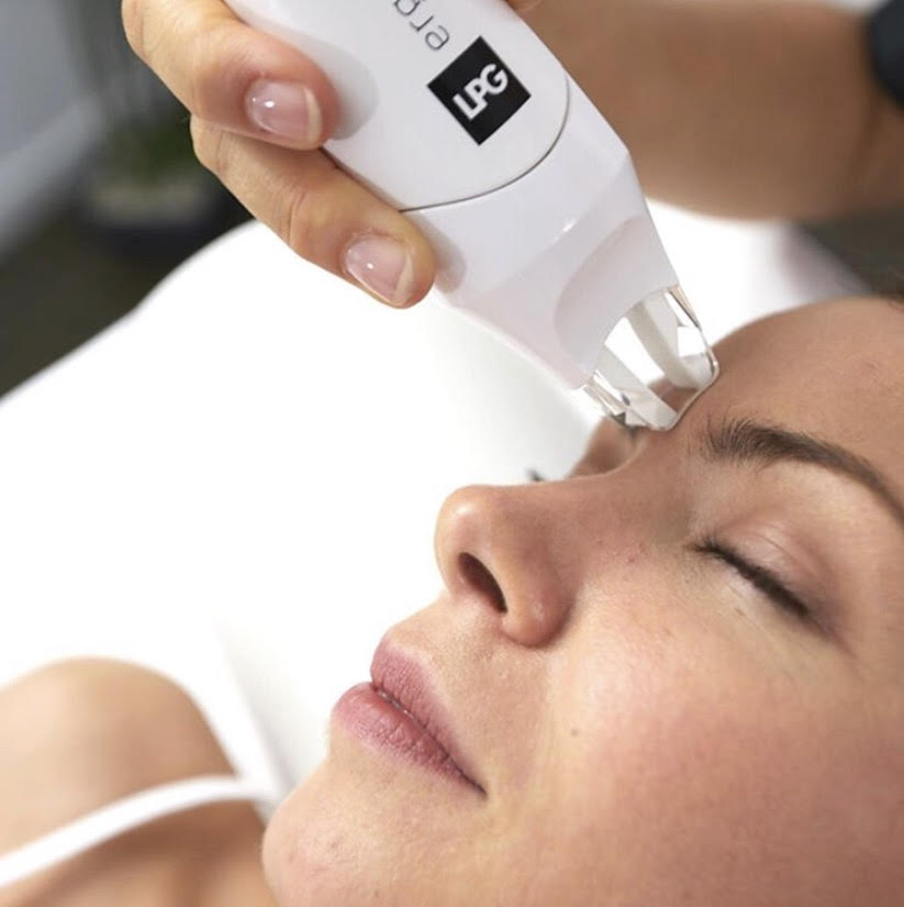 You are currently viewing Cures LPG Visage
